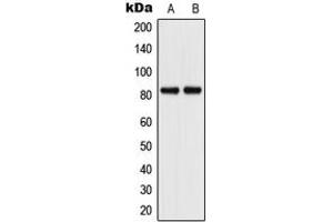 Western blot analysis of CD106 expression in A549 (A), HuvEc (B) whole cell lysates. (VCAM1 Antikörper  (Center))