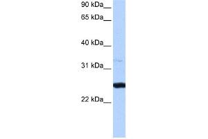 WB Suggested Anti-PRTFDC1 Antibody Titration:  0. (PRTFDC1 Antikörper  (Middle Region))