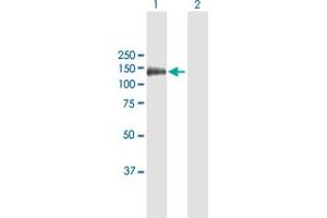 Western Blot analysis of ENPP1 expression in transfected 293T cell line by ENPP1 MaxPab polyclonal antibody. (ENPP1 Antikörper  (AA 1-873))