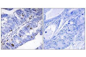 Immunohistochemistry (IHC) image for anti-Nuclear Receptor Subfamily 4, Group A, Member 1 (NR4A1) (pSer351) antibody (ABIN1847422) (NR4A1 Antikörper  (pSer351))