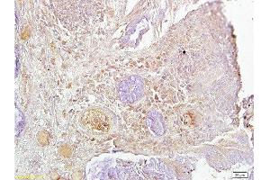 Immunohistochemistry (Paraffin-embedded Sections) (IHC (p)) image for anti-Antigen Identified By Monoclonal Antibody Ki-67 (MKI67) (AA 1201-1300) antibody (ABIN677858)