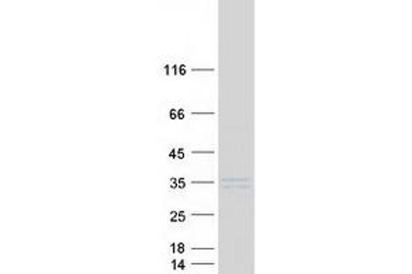 ELA2B Protein (Myc-DYKDDDDK Tag)