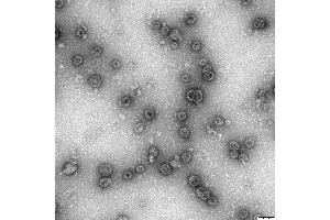 Transmission electron microscopy (TEM) image for Human Papilloma Virus 11 Capsid Protein (HPV11 L1) protein-VLP (ABIN7540348)