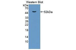 Western Blotting (WB) image for anti-Lipopolysaccharide Binding Protein (LBP) antibody (Biotin) (ABIN1174580) (LBP Antikörper  (Biotin))