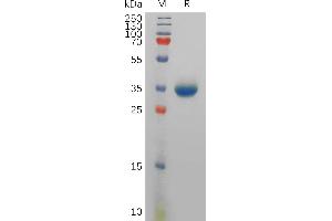 Human PYY Protein, hFc Tag on SDS-PAGE under reducing condition. (Peptide YY Protein (PYY) (Fc Tag))