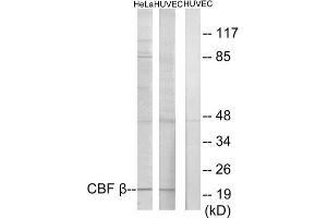 Western Blotting (WB) image for anti-Core-Binding Factor, beta Subunit (CBFB) (N-Term) antibody (ABIN1849582) (CBFB Antikörper  (N-Term))