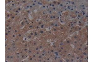 Detection of MAP3K1 in Human Liver Tissue using Polyclonal Antibody to Mitogen Activated Protein Kinase Kinase Kinase 1 (MAP3K1) (MAP3K1 Antikörper  (AA 1307-1509))