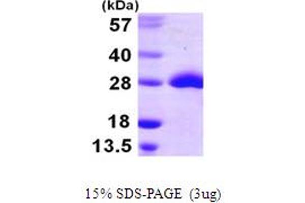 MSRA Protein (AA 1-212) (His tag)