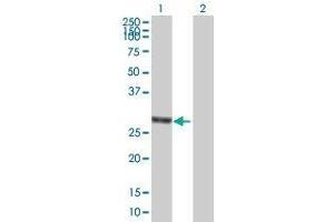 Lane 1: ANKRD29 transfected lysate ( 32. (ANKRD29 293T Cell Transient Overexpression Lysate(Denatured))