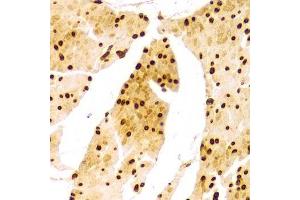 Immunohistochemistry (Paraffin-embedded Sections) (IHC (p)) image for anti-Lamin A/C (LMNA) (AA 403-572) antibody (ABIN3020785)