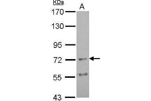 WB Image Sample (30 ug of whole cell lysate) A: U87-MG 7. (AChR alpha 4 (Center) Antikörper)