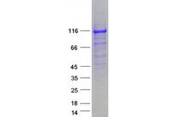 NEDD4-2 Protein (Transcript Variant B) (Myc-DYKDDDDK Tag)