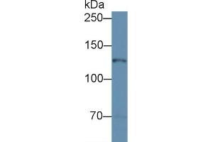 Detection of NOS2 in Mouse Cerebellum lysate using Polyclonal Antibody to Nitric Oxide Synthase 2, Inducible (NOS2) (NOS2 Antikörper  (AA 526-659))