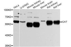 Western blot analysis of extracts of various cell lines, using CAT Antibody (ABIN5997374) at 1:3000 dilution. (Catalase Antikörper)