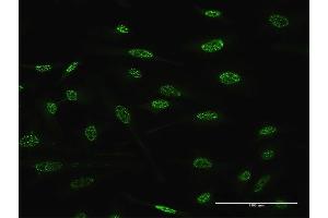 Immunofluorescence of monoclonal antibody to TGIF2 on HeLa cell. (TGIF2 Antikörper  (AA 114-175))