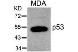 Image no. 1 for anti-Tumor Protein P53 (TP53) (AA 4-8) antibody (ABIN319299) (p53 Antikörper  (AA 4-8))