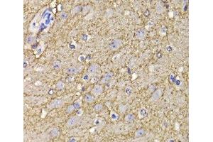 Immunohistochemistry of paraffin-embedded Mouse brain using KCND3 Polyclonal Antibody at dilution of 1:100 (40x lens). (KCND3 Antikörper)