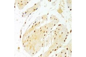 Immunohistochemistry of paraffin-embedded Human esophageal using DKC1 antibody at dilution of 1:100 (x400 lens). (DKC1 Antikörper)