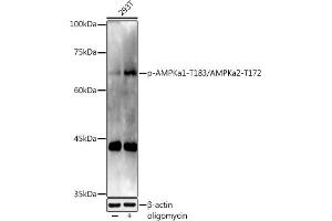 Western blot analysis of extracts of 293T cells, using Phospho-AMPKa1-T183/AMPKa2-T172 antibody (ABIN3020441, ABIN3020442, ABIN3020443 and ABIN1681942) at 1:1000 dilution. (AMPK alpha Antikörper  (pThr172))