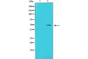 Western blot analysis of Cyclin E1 phosphorylation expression in Paclitaxel treated HeLa whole cell lysates,The lane on the left is treated with the antigen-specific peptide. (Cyclin E1 Antikörper  (pThr395))