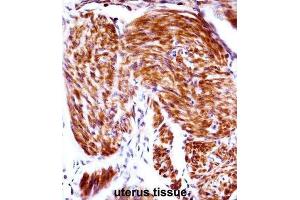 Immunohistochemistry (IHC) image for anti-Progestagen-Associated Endometrial Protein (PAEP) antibody (ABIN2998090) (PAEP Antikörper)