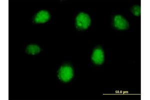 Immunofluorescence of purified MaxPab antibody to RARB on HeLa cell. (Retinoic Acid Receptor beta Antikörper  (AA 1-448))
