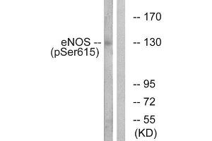 Western Blotting (WB) image for anti-Nitric Oxide Synthase 3 (Endothelial Cell) (NOS3) (pSer615) antibody (ABIN1847410) (ENOS Antikörper  (pSer615))