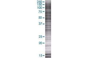 UBE2G1 transfected lysate. (UBE2G1 293T Cell Transient Overexpression Lysate(Denatured))