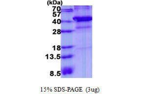 XRCC3 Protein