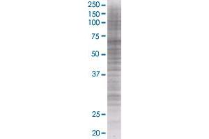 MDM4 transfected lysate. (MDM4 293T Cell Transient Overexpression Lysate(Denatured))