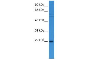 Western Blotting (WB) image for anti-Growth Arrest and DNA-Damage-Inducible, alpha (GADD45A) (C-Term) antibody (ABIN2788360) (GADD45A Antikörper  (C-Term))