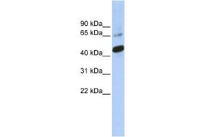 WB Suggested Anti-SOX1 Antibody Titration:  0. (SOX1 Antikörper  (Middle Region))