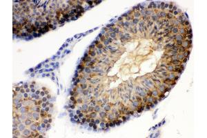 Immunohistochemistry (Paraffin-embedded Sections) (IHC (p)) image for anti-Heat Shock Protein 90kDa alpha (Cytosolic), Class A Member 1 (HSP90AA1) (AA 454-488), (C-Term) antibody (ABIN3043848) (HSP90AA1 Antikörper  (C-Term))