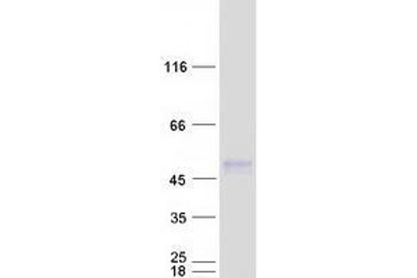 TMEM51 Protein (Transcript Variant 4) (Myc-DYKDDDDK Tag)