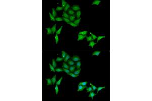 Immunofluorescence analysis of HeLa cells using CCNC antibody. (Cyclin C Antikörper)