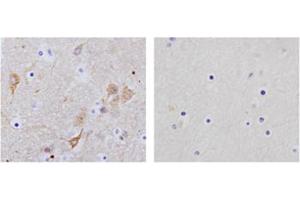 Immunohistochemistry analysis of human brain tissue slide (Paraffin embedded) using Rabbit Anti-NSE Polyclonal Antibody (Left, ABIN398881) and Purified Rabbit IgG (Whole molecule) Control (Right, ABIN398653) (ENO2/NSE Antikörper  (C-Term))