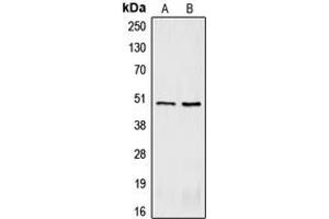 Western blot analysis of CRHR2 expression in BC3H1 (A), U87MG (B) whole cell lysates. (CRHR2 Antikörper  (Center))