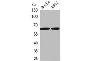 Western Blot analysis of HuvEc, K562 cells using OAT1 Polyclonal Antibody. (SLC22A6 Antikörper  (N-Term))