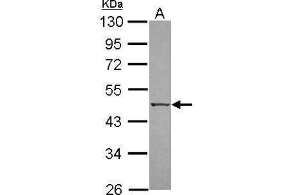 DAPK3 Antikörper  (N-Term)