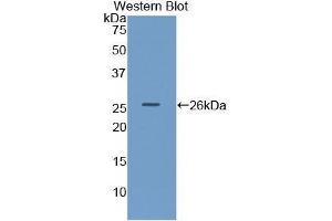 Western Blotting (WB) image for anti-Lipase, Hepatic (LIPC) (AA 25-247) antibody (ABIN1859670) (LIPC Antikörper  (AA 25-247))