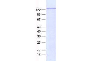 Validation with Western Blot (Cadherin 20 Protein (CDH20) (His tag))