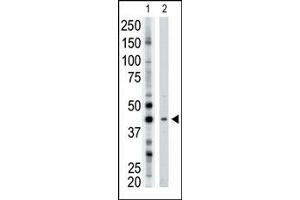 Image no. 1 for anti-ADP-Ribosyltransferase 3 (ART3) (N-Term) antibody (ABIN357663) (ART3 Antikörper  (N-Term))