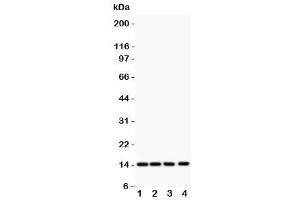 Western blot testing of PDGF-B antibody and Lane 1:  rat heart (PDGFB Antikörper  (AA 82-190))