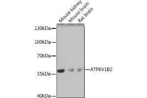 Western blot analysis of extracts of various cell lines, using V1B2 Rabbit pAb  at 1:1000 dilution. (ATP6V1B2 Antikörper  (AA 262-511))