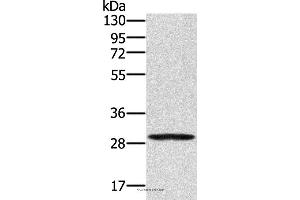 Western blot analysis of 293T cell, using EDA2R Polyclonal Antibody at dilution of 1:250 (Ectodysplasin A2 Receptor Antikörper)
