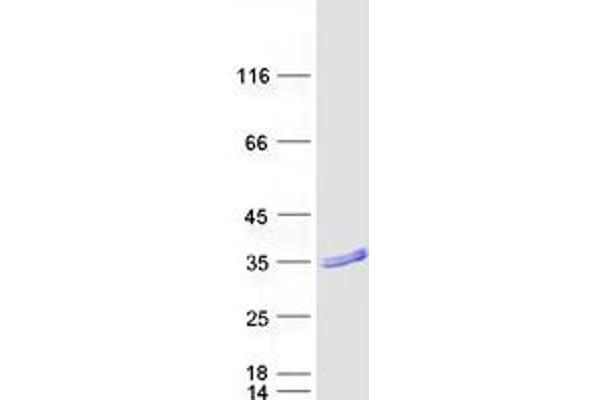 RAB37 Protein (Transcript Variant 2) (Myc-DYKDDDDK Tag)