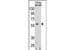 SMAD5 Antibody pre-incubated without(lane 1) and with(lane 2) blocking peptide in Hela cell line lysate. (SMAD5 Antikörper  (AA 241-269))