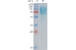 Mouse GC Protein, His Tag on SDS-PAGE under reducing condition. (GUCY2C Protein (AA 20-433) (His tag))
