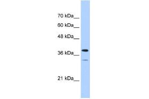 WB Suggested Anti-PGAM2 Antibody Titration:  0. (PGAM2 Antikörper  (N-Term))