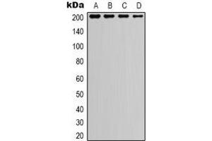 Western blot analysis of TSC2 expression in A549 (A), HEK293T (B), NIH3T3 (C), mouse kidney (D) whole cell lysates. (Tuberin Antikörper)